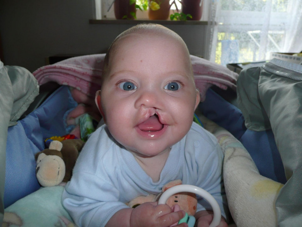 Julka słoneczko operacja na 15 listopada 2007