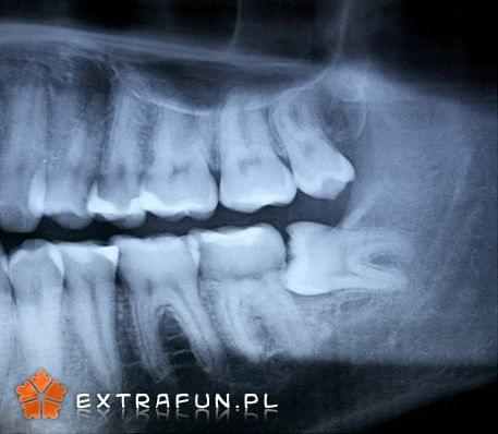 www.extrafun.pl #extrafun