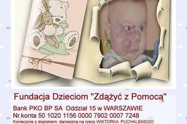 http://pomagamy.dbv.pl/ #Apel #ChoreDzieci #darowizna #Fiedziuszko #FundacjaDzieciom #ZdążyćZPomocą #leczenie #LeczenieLaserem #NaczyniakJamisty #OperacjaPlastyczna #OpiekaRehabilitacyjna #PomocCharytatywna #PomocDzieciom #PomocnaDłoń #pomóż